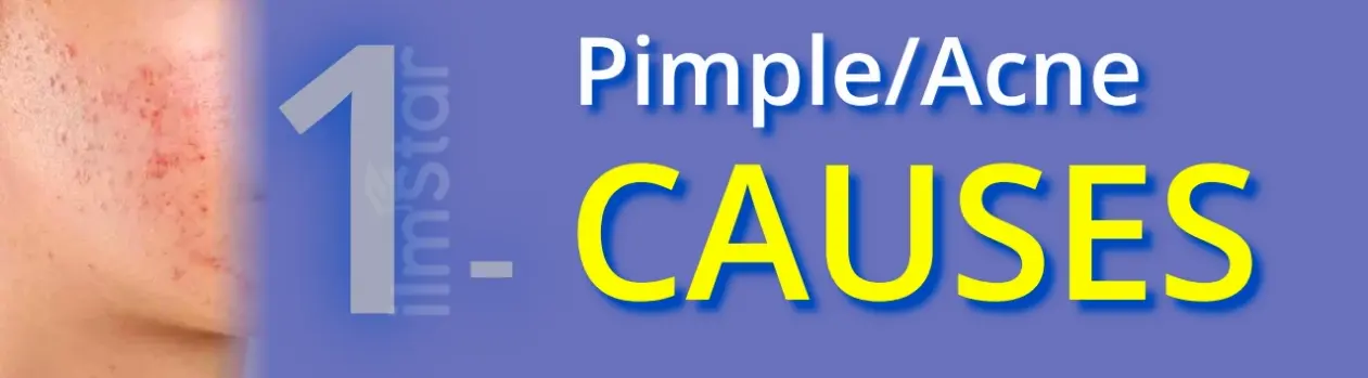 Causes of Pimples (Why do pimples come on the face?):